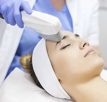 IPL Treatment laser