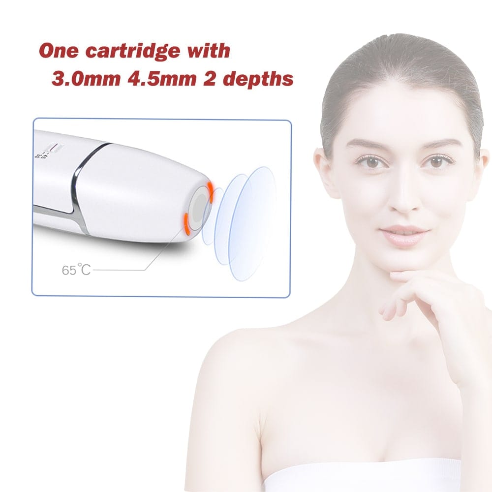4D Radar carving treatment laser